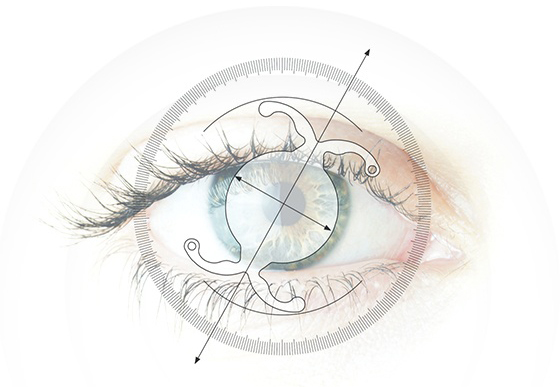 Lente cheap tórica intraocular